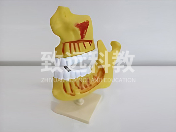 儿童牙列模型